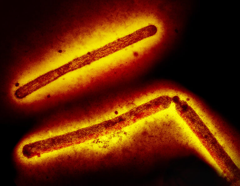 Three influenza A (H5N1, bird flu, avian flu) virus particles (rod-shaped). Note: Layout incorporates two CDC transmission electron micrographs that have been inverted, repositioned, and colorized by NIAID. Scale has been modified.