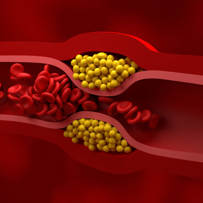 Red blood cells flowing in a vessel was squeezed by two group of yellow balls — in the lab coverage from STAT