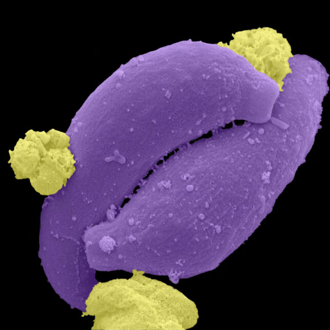 A purple and yellow Microscopy photograph of the malaria parasite