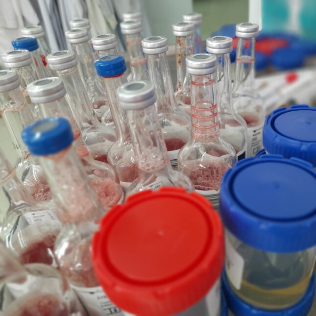 A collection of microbiological specimen containers -- BACTEC bottles towards the upper left corner. -- health coverage from sTAT